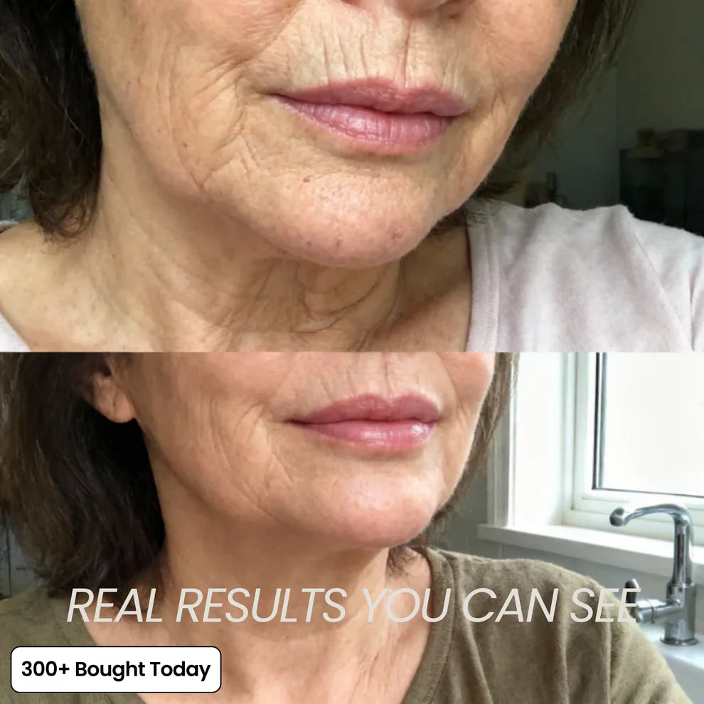 Multi-Purpose Calcium Skin BaIm Transform Wrinkles Within Days Guaranteed(Limited Supply!)