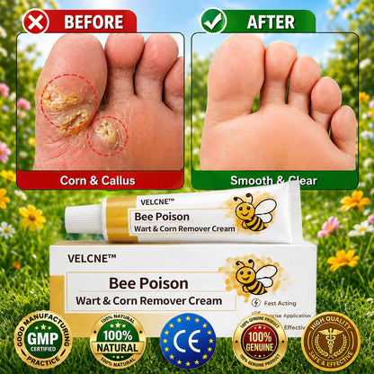 👩‍⚕️Velcne™Bee Poison Wart & Corn Remover Cream