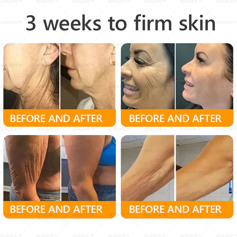 APKAP®Bee venomSkin Restoration Creaml💎💎 Powerful anti-aging solution that targets deepwrinkles,fine lines,sagging skin,and dryness