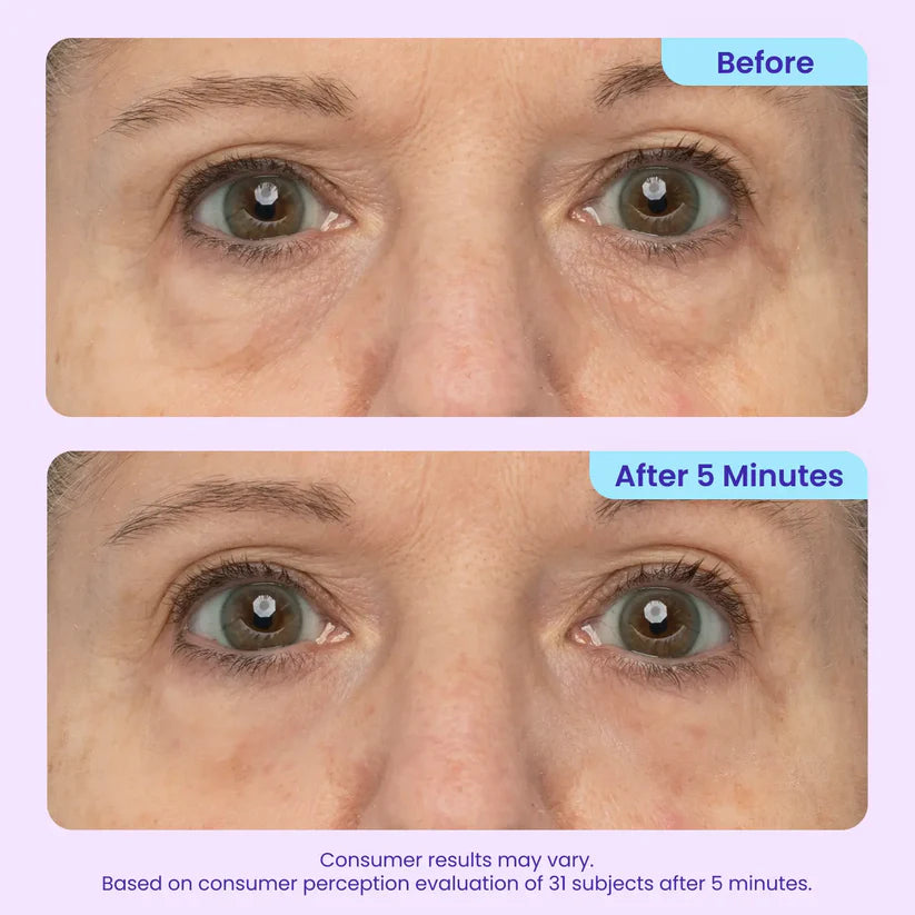 Erase Eye Bags in Minutes — Luxlue Eye Cream Look Refreshed Instantly ⚡Flash Sale🔥