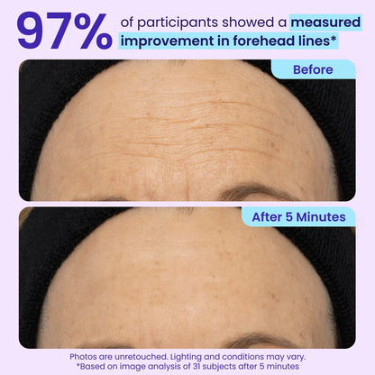 Erase Eye Bags in Minutes — Luxlue Eye Cream Look Refreshed Instantly ⚡Flash Sale🔥