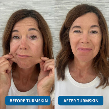 Luxevéria : Clinical-Grade Collagen That Erases Deep Lines Without Needles