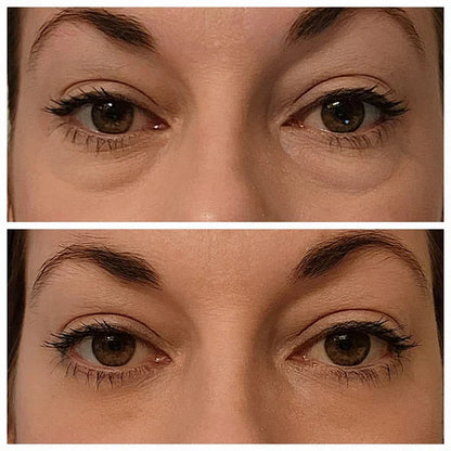🔥Last Day 49% OFF🎁Instant Eye Temporary Eye Tightener