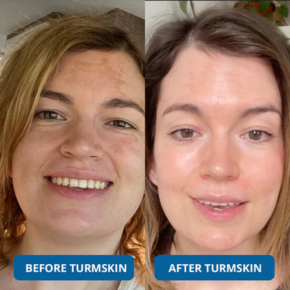 Luxevéria : Clinical-Grade Collagen That Erases Deep Lines Without Needles