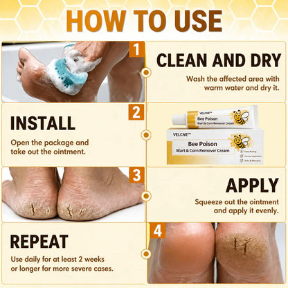👩‍⚕️Velcne™Bee Poison Wart & Corn Remover Cream