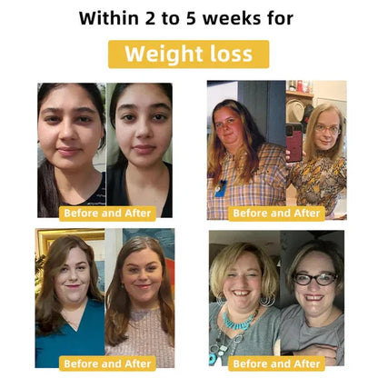👾Lose weight quickly and regain your beauty.
