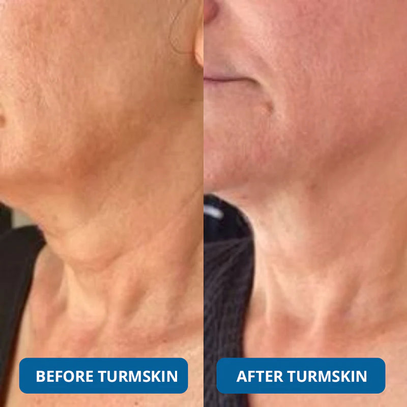Luxevéria : Clinical-Grade Collagen That Erases Deep Lines Without Needles