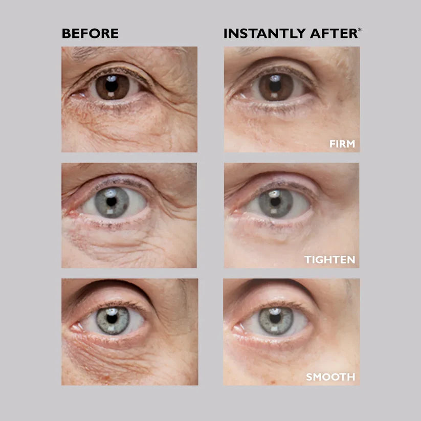 💖Divifit™ Eye Bag Eraser-Say Goodbye to Puffy Eyes and Wrinkles in Just 15 Minutes!
