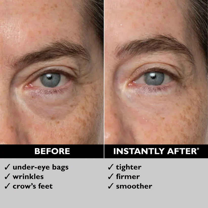 💖Divifit™ Eye Bag Eraser-Say Goodbye to Puffy Eyes and Wrinkles in Just 15 Minutes!