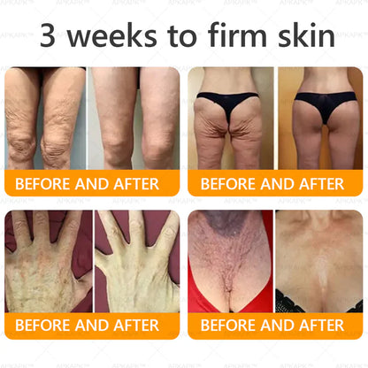 APKAP®Bee venomSkin Restoration Creaml💎💎 Powerful anti-aging solution that targets deepwrinkles,fine lines,sagging skin,and dryness