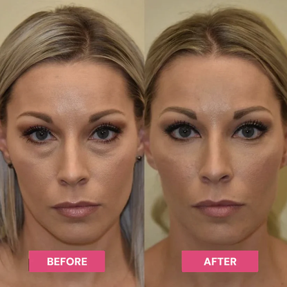 💓Revive Tired Eyes -Hydrating & Anti-Wrinkle Eye Balm💘