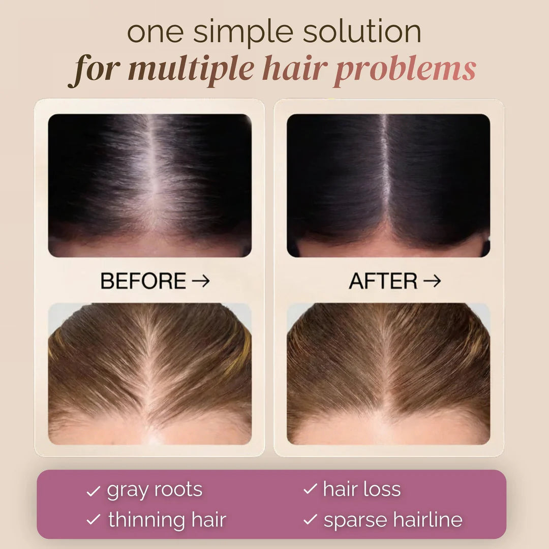 🔥BUY 1 GET 1 FREE🔥Hair Concealer – Instantly Covers Gray Roots & Thinning Hair