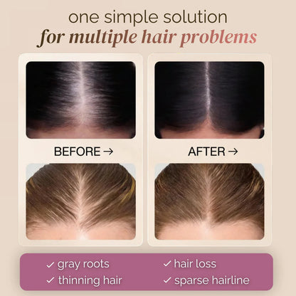 🔥BUY 1 GET 1 FREE🔥Hair Concealer – Instantly Covers Gray Roots & Thinning Hair