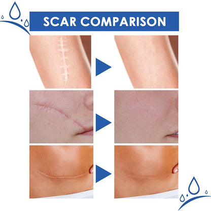 ✨ LAST DAY BUY 1 GET 1 FREE✨Scar Repair Cream for Men and Women, fade scars and tighten skin in one step
