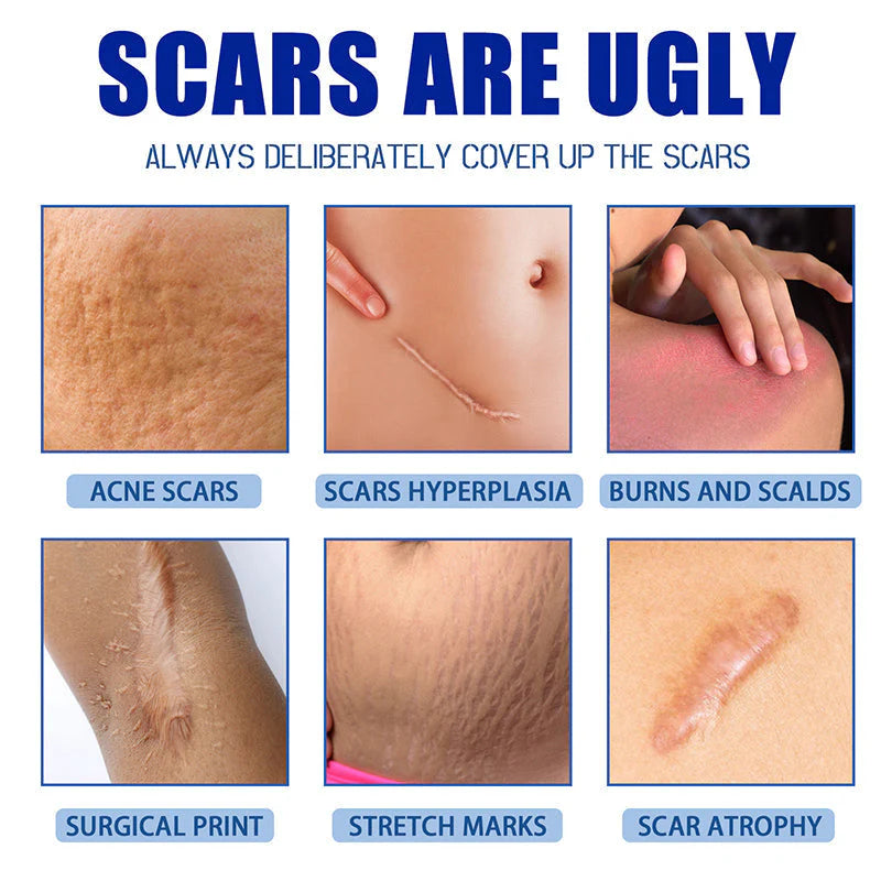 ✨ LAST DAY BUY 1 GET 1 FREE✨Scar Repair Cream for Men and Women, fade scars and tighten skin in one step