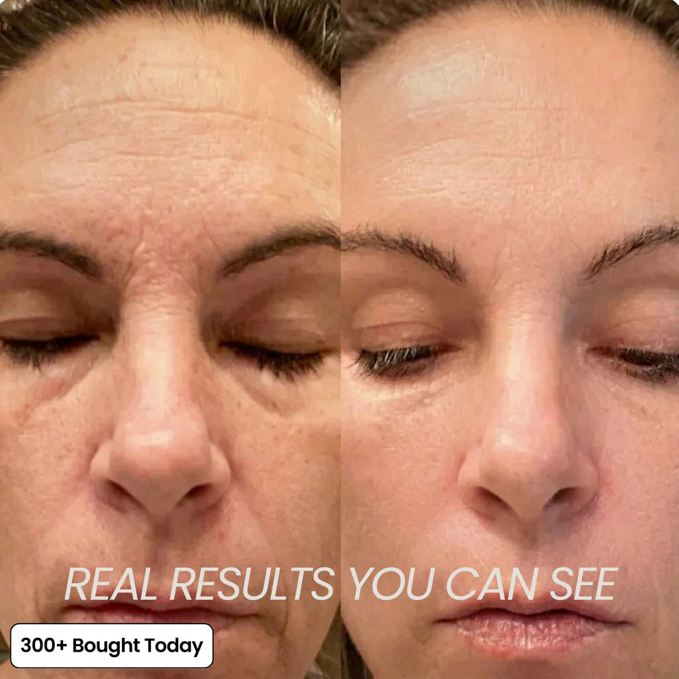 Multi-Purpose Calcium Skin BaIm Transform Wrinkles Within Days Guaranteed(Limited Supply!)
