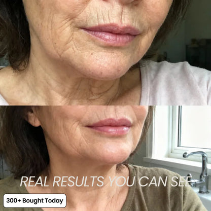 Multi-Purpose Calcium Skin BaIm Transform Wrinkles Within Days Guaranteed(Limited Supply!)